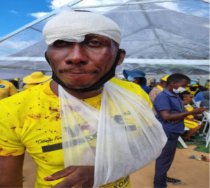 A CCC supporter, known as Misheck Chikwinya (39), who experienced an attack by ZANU PF supporters while attending a rally in Kwekwe in February 2022. Credit: The Newshawks