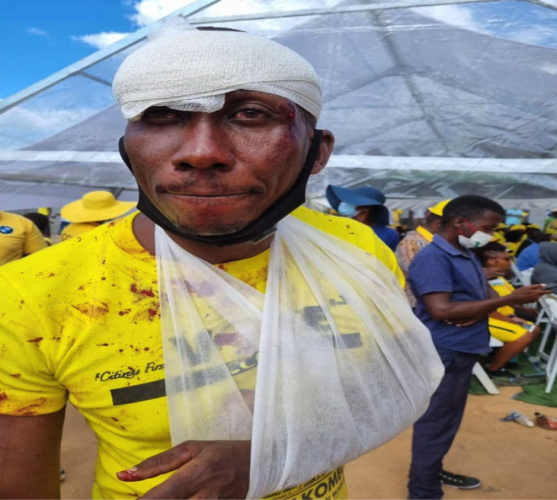 A CCC supporter, known as Misheck Chikwinya (39), who experienced an attack by ZANU PF supporters while attending a rally in Kwekwe in February 2022. Credit: The Newshawks